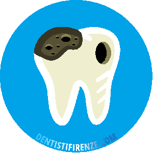 Otturazione Carie Dentali Firenze